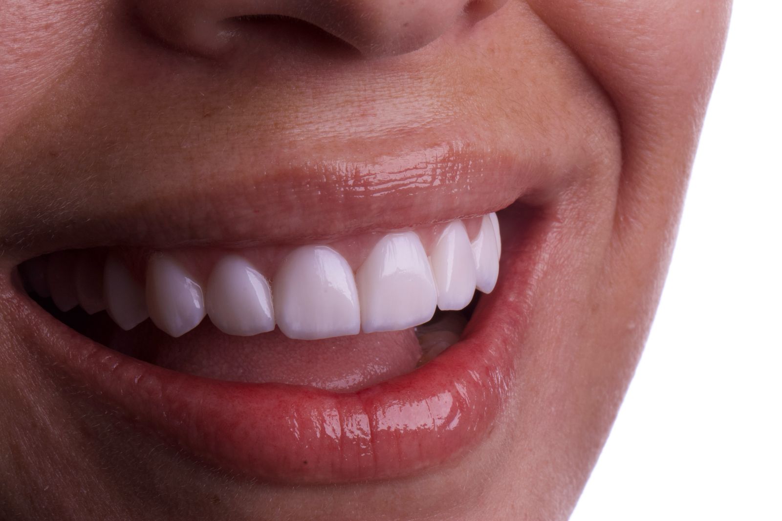 Caso Clínico 1 - Reabilitação Estética